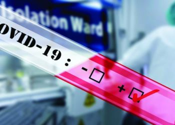 Κοζάνη: ΕΟΔΥ – Πού θα γίνονται σήμερα δωρεάν Rapid Test σήμερα, Σάββατο 26/2