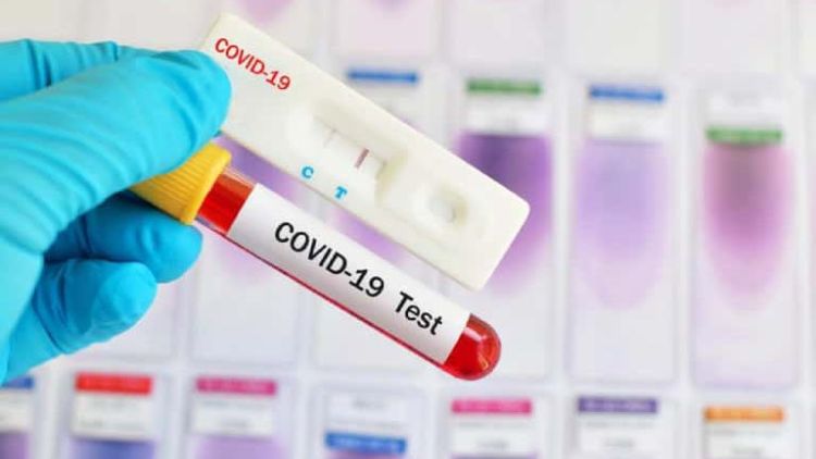 Κοζάνη: ΕΟΔΥ – Πού θα γίνονται σήμερα δωρεάν Rapid Test σήμερα, Δευτέρα 21/3