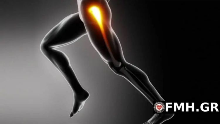 Τροχαντηρίτιδα ισχίου: Ποιες είναι οι αιτίες και ποια η θεραπεία