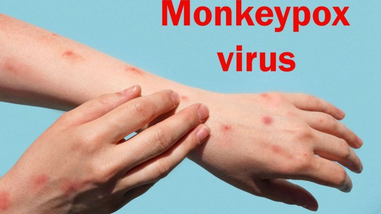 Ευλογιά των πιθήκων: Γιατί ο ΠΟΥ αποφάσισε να κηρύξει παγκόσμιο συναγερμό