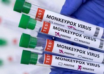 Ευλογιά των πιθήκων: 50 κρούσματα στην Ελλάδα – Τι δείχνουν τα στοιχεία του ΕΟΔΥ