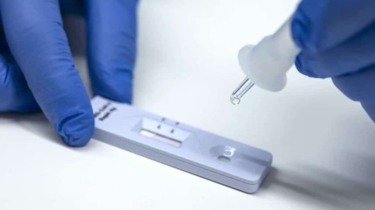 Κοζάνη: Σημεία Rapid Test για σήμερα, Παρασκευή 12/8