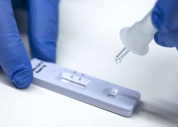 Κοζάνη: Σημεία Rapid Test για σήμερα, Σάββατο 6/8