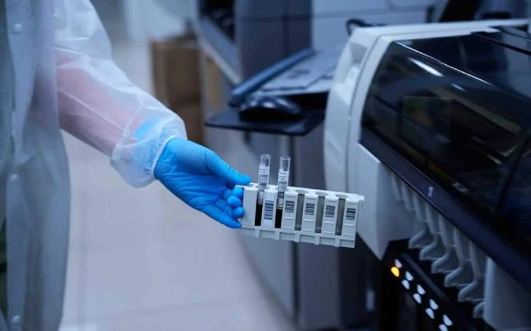 ΕΟΔΥ: 168 θάνατοι από κορονοϊό την τελευταία εβδομάδα – Δύο από γρίπη