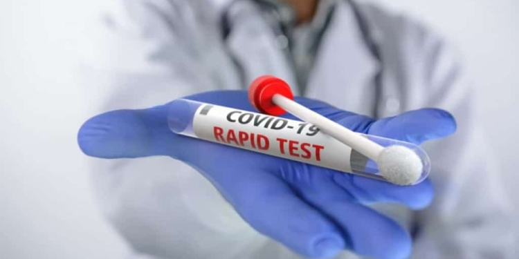 Κοζάνη: Σημεία Μαζικών Δωρεάν Rapid Test Για Σήμερα Κυριακή 29/1