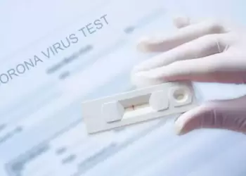 Σημεία στην Κοζάνη μαζικών δωρεάν Rapid Test για σήμερα Πέμπτη 30/3