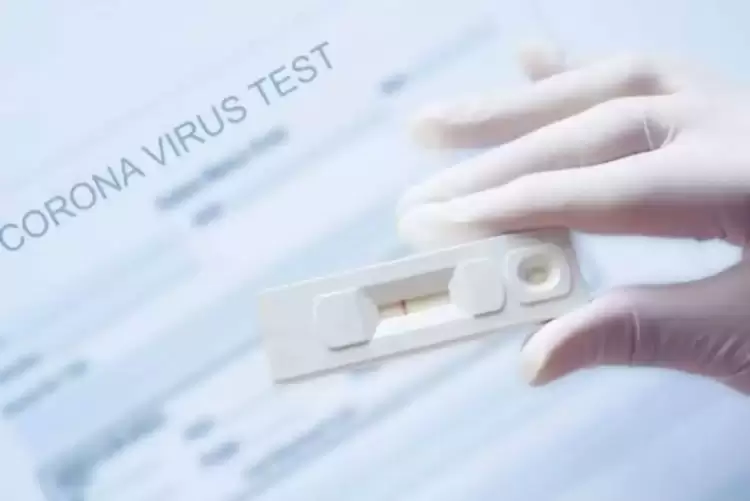 Σημεία στην Κοζάνη μαζικών δωρεάν Rapid Test για σήμερα Παρασκευή 7/4