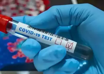 Σημεία στην Κοζάνη μαζικών δωρεάν Rapid Test για σήμερα Πέμπτη 6/4