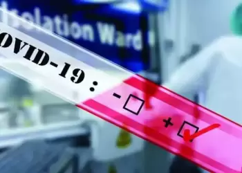 Σημεία στην Κοζάνη μαζικών δωρεάν Rapid Test για σήμερα Τρίτη 4/4