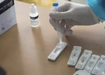 Σημεία rapid test στην Κοζάνη για σήμερα Δευτέρα 11/12