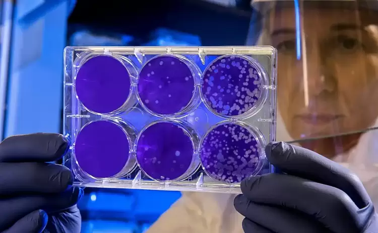 Tι είναι η οξεία βακτηριακή λοίμωξη που σκότωσε την Ντέμη Γεωργίου Tι είναι η οξεία βακτηριακή λοίμωξη που σκότωσε την Ντέμη Γεωργίου