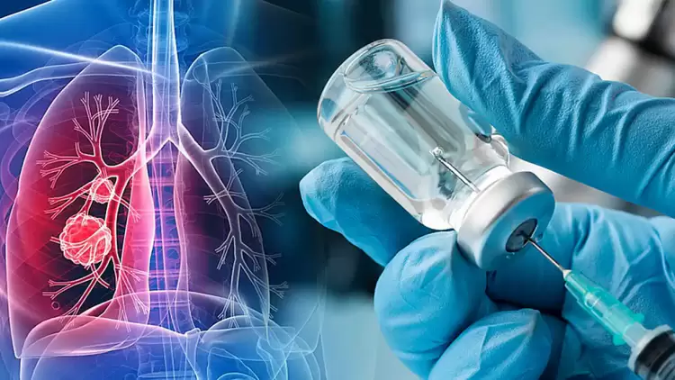 Ιστορική εξέλιξη: Αρχισαν οι δοκιμές εμβολίου για τον καρκίνο του πνεύμονα Ιστορική εξέλιξη: Αρχισαν οι δοκιμές εμβολίου για τον καρκίνο του πνεύμονα