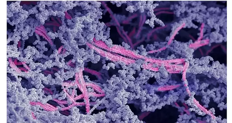 Νέο βιοϋλικό αναγεννά τον κατεστραμμένο χόνδρο στις αρθρώσεις Νέο βιοϋλικό αναγεννά τον κατεστραμμένο χόνδρο στις αρθρώσεις