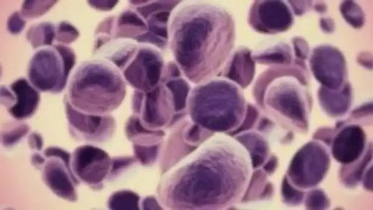 Ερευνητές δύο αμερικανικών Πανεπιστημίων, με επικεφαλής τον Κώστα Αρβανίτη, ανέπτυξαν καινοτόμο μέθοδο για απεικόνιση, διάγνωση και θεραπεία καρκίνου