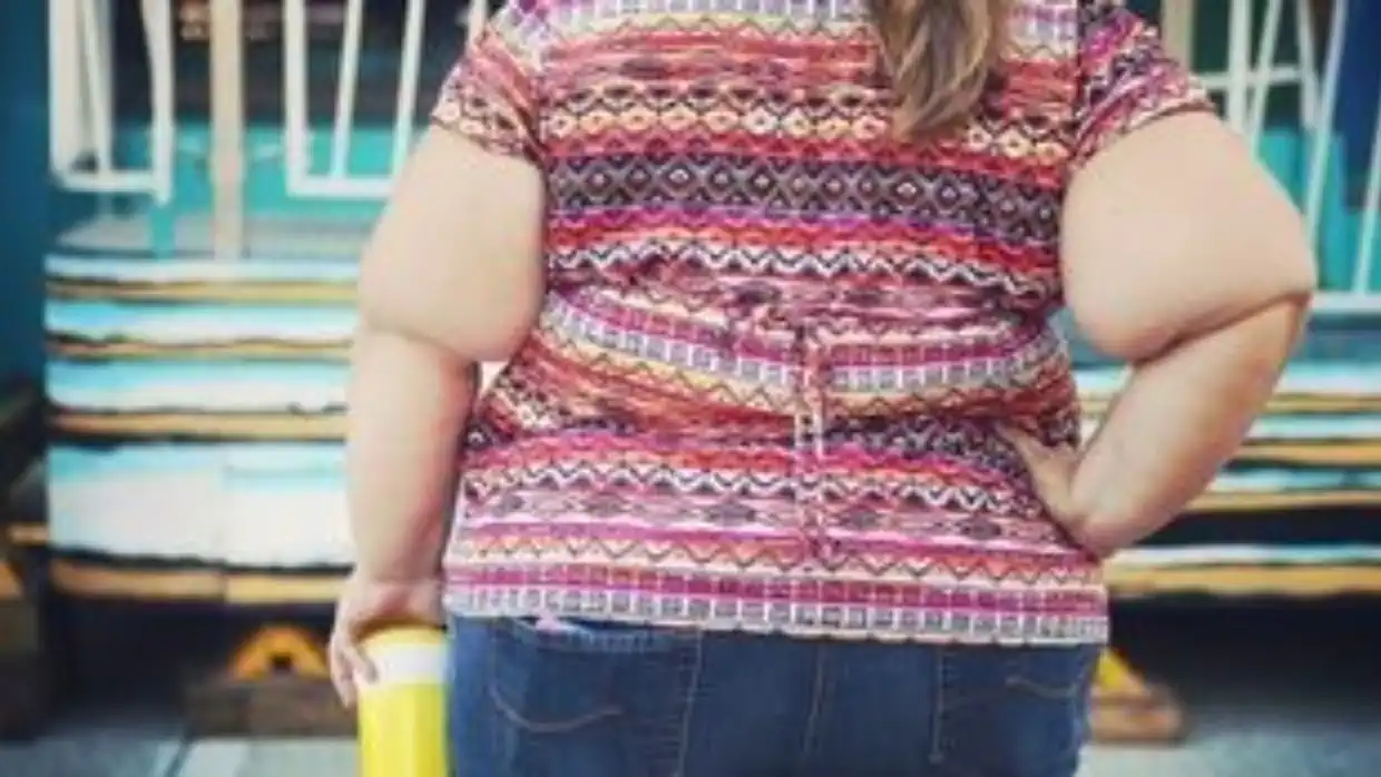 Η παχυσαρκία επηρεάζει τη γονιμότητα – Τι δείχνουν μελέτες